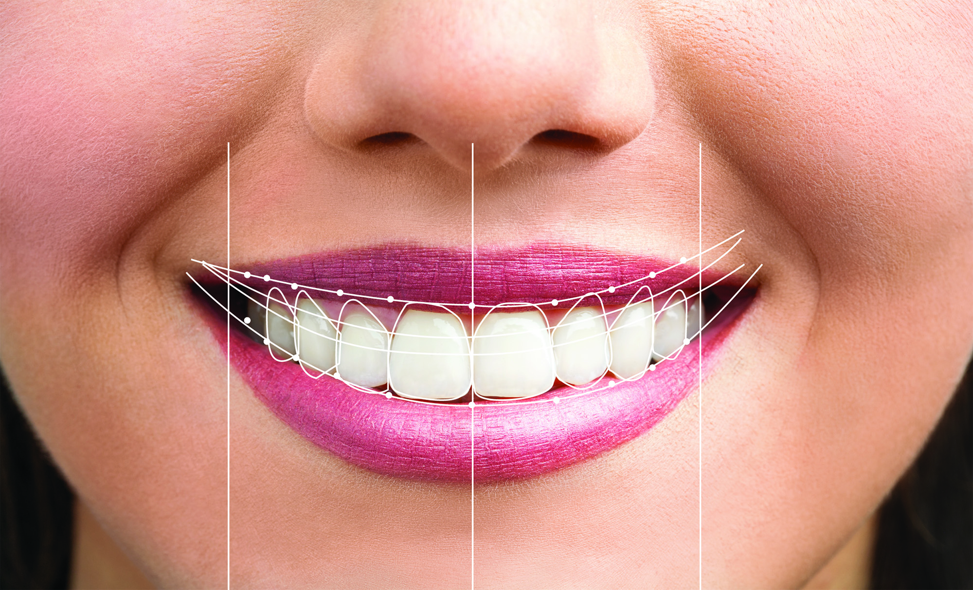 Digital Smile Designing — Cusp Dental And Maxillofacial Centre