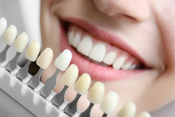 Benefits Of Cosmetic Teeth Surgery