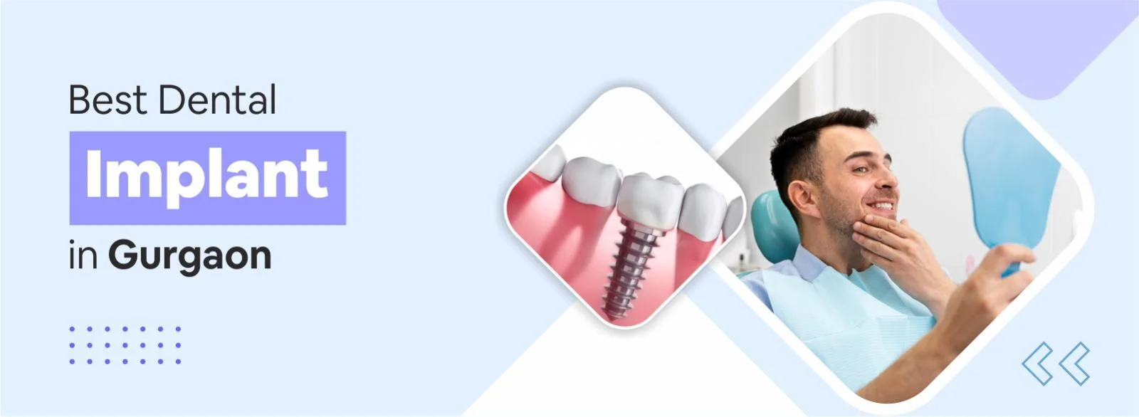 Best Dental Implant Treatment in Gurgaon