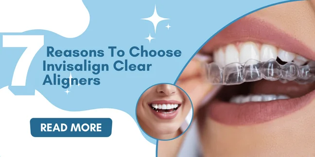 7 Reasons To Choose Invisalign Clear Aligners