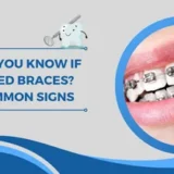 how do you know if you need braces