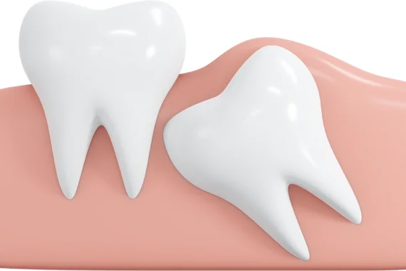 Types Of Cosmetic Teeth Surgery