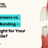 Porcelain Veneers vs. Composite Bonding – Which is Right for Your Perfect Smile