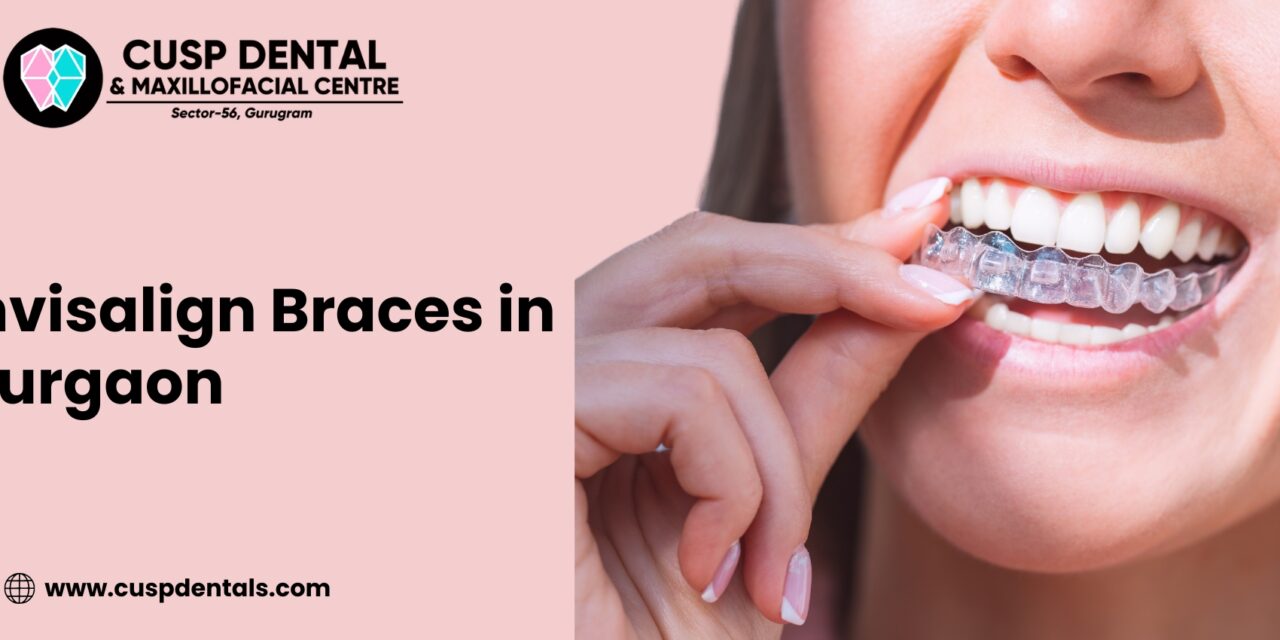 Invisalign Braces in Gurgaon