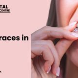 Invisalign Braces in Gurgaon
