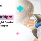 dental-crown-vs-dental-bridge-gurgaon