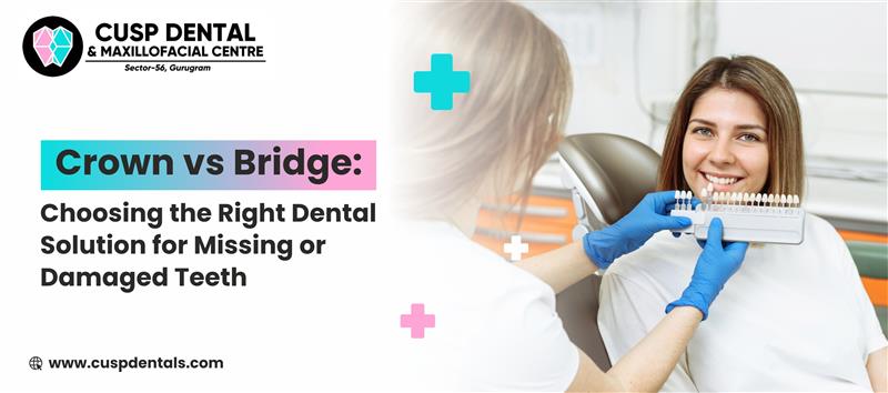 Crown vs Bridge: Choosing the Right Dental Solution for Missing or Damaged Teeth
