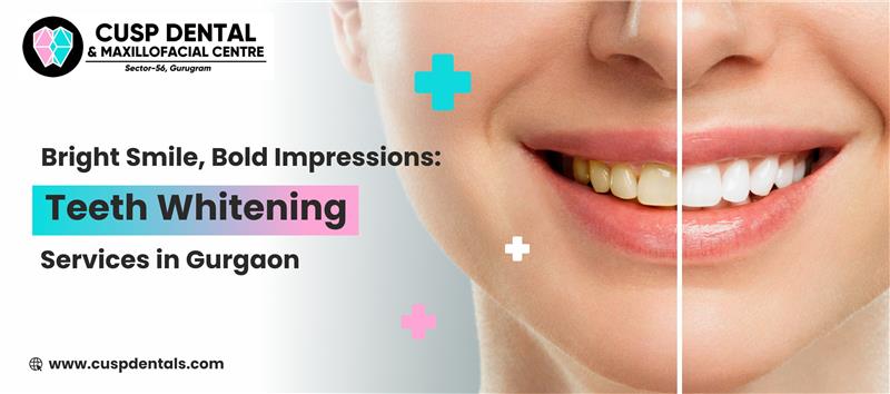 Bright Smile, Bold Impressions: Teeth Whitening Services in Gurgaon