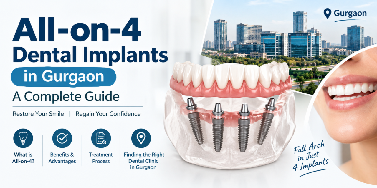 All-on-4 Dental Implants in Gurgaon: A Complete Guide