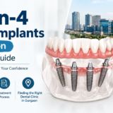 All-on-4 Dental Implants in Gurgaon A Complete Guide